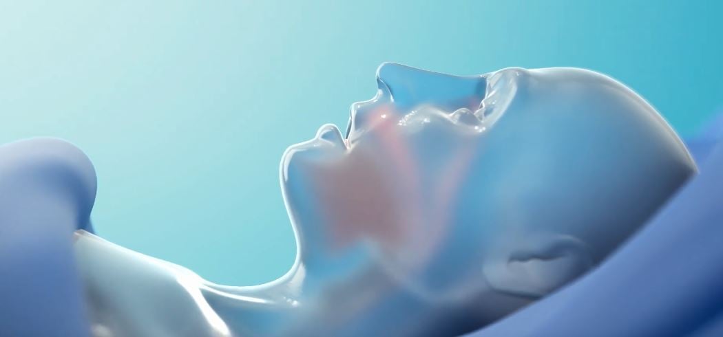 Apnimed (APMD) Eyes $150 Million IPO as FDA Review Puts Oral Sleep Apnea Therapy Within Reach
